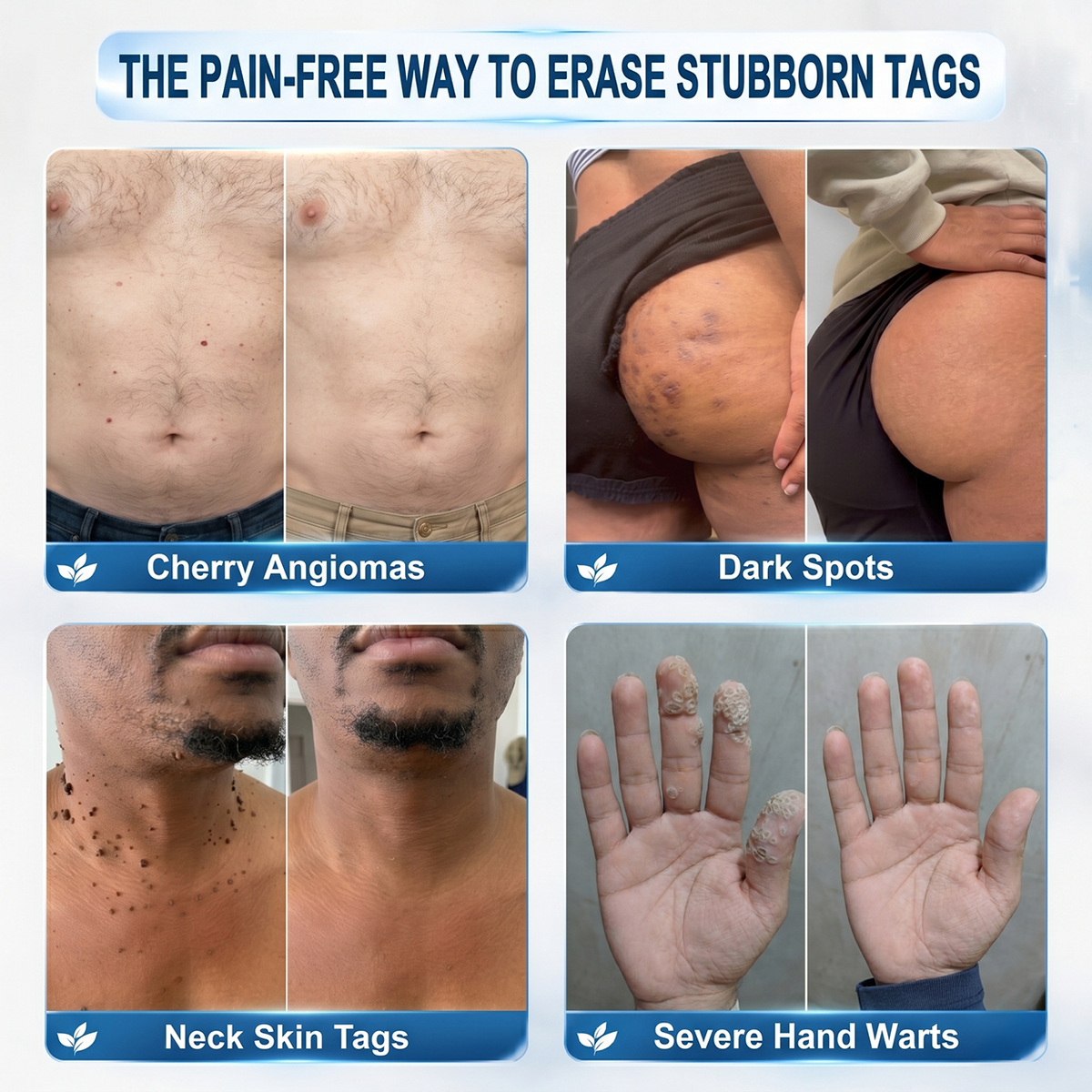 𝐏i𝐜𝐝o® 7-𝐷𝑎𝑦 𝗧𝐚𝐠 & 𝗦𝗽𝐨𝐭 𝐄𝐫𝒂𝒔𝒆𝒓✅🚀(Zero Pain, Zero 𝐒𝐜𝐚𝒓𝒔 Rollerball)