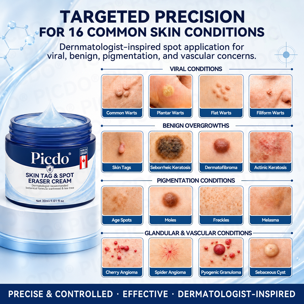𝐏𝐢𝐜𝐝𝐨® 7-𝐃𝐚𝐲 𝐒𝐤𝐢𝐧 𝐓𝐚𝐠 & 𝐒𝐩𝐨𝐭 𝐄𝐫𝐚𝐬𝐞𝐫 𝐂𝐫𝐞𝐚𝐦 (Zero Pain, Zero 𝐒𝐜𝐚𝐫𝐬 Formula) 🍁